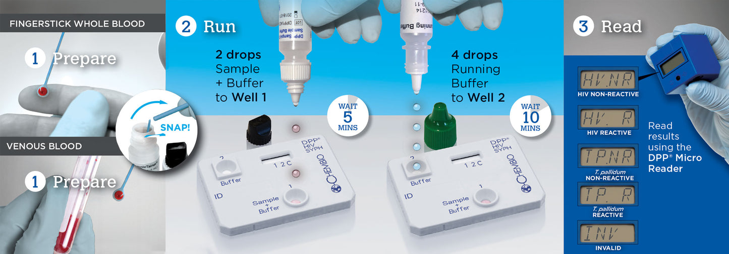 (Box) CHEMBIO DPP® HIV-Syphilis, Antibody, 20/Bx