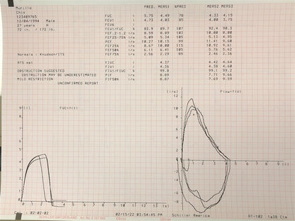(Each) Crdvt AT102 Sys ECG Nw w/ Intrprtn Memry/SCM Ethrnt Wrd LAN/Sprmtry/50 Mthpcs Ea
