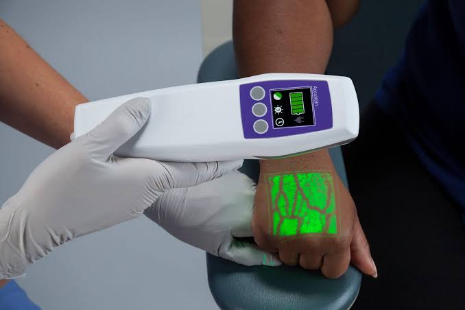AccuVein AV500 Handheld Vein Visualization System(Refurbished)